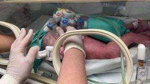 Nacen siamesas en Guadalupe, Nuevo León