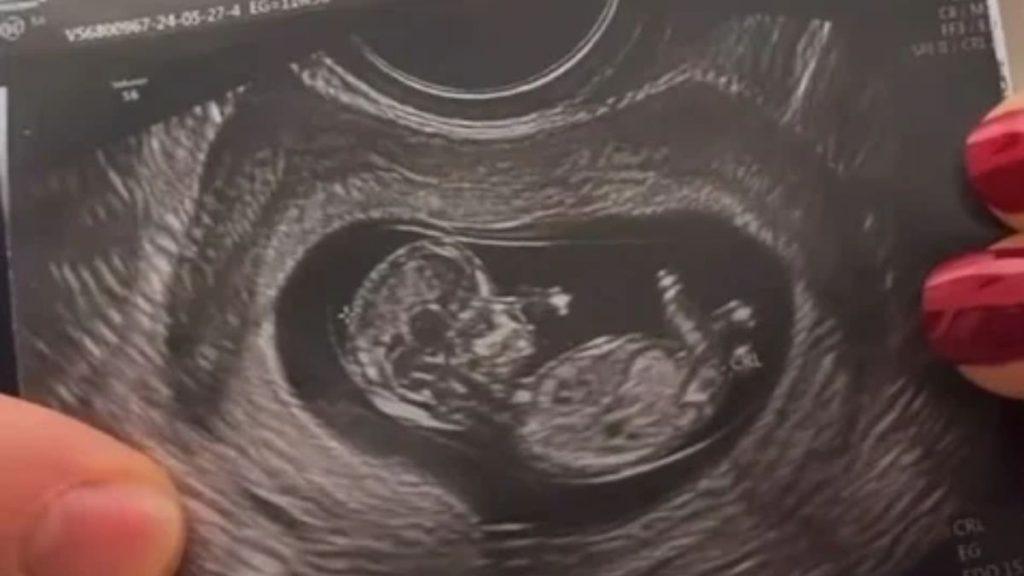 Ecografía de Mariana Rodríguez